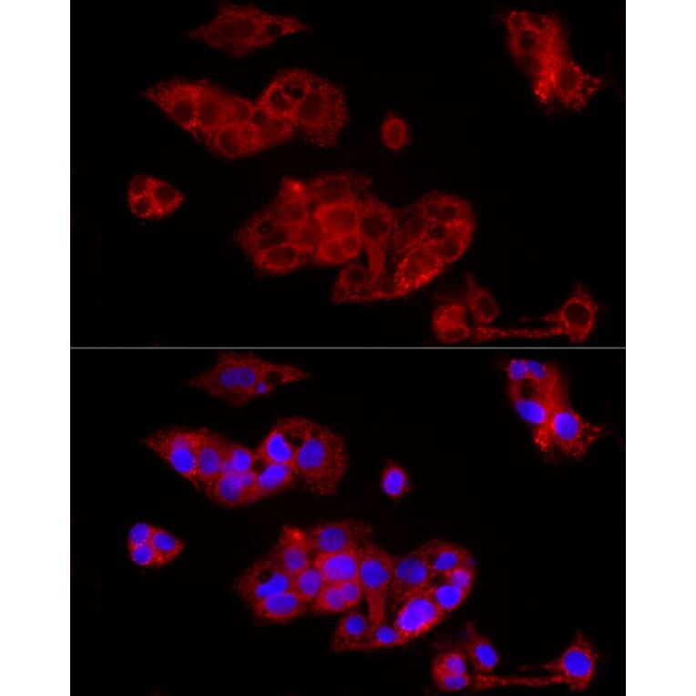 Immunofluorescence - Anti-FGF1 Antibody (A92157) - Antibodies.com