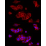 Immunofluorescence - Anti-FGF1 Antibody (A92157) - Antibodies.com