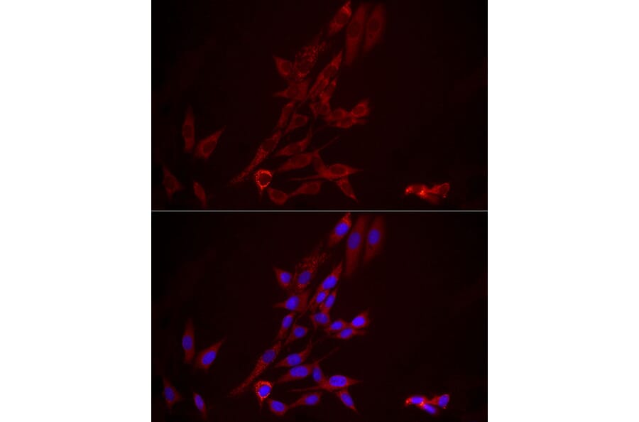 Immunofluorescence - Anti-FGF1 Antibody (A92157) - Antibodies.com