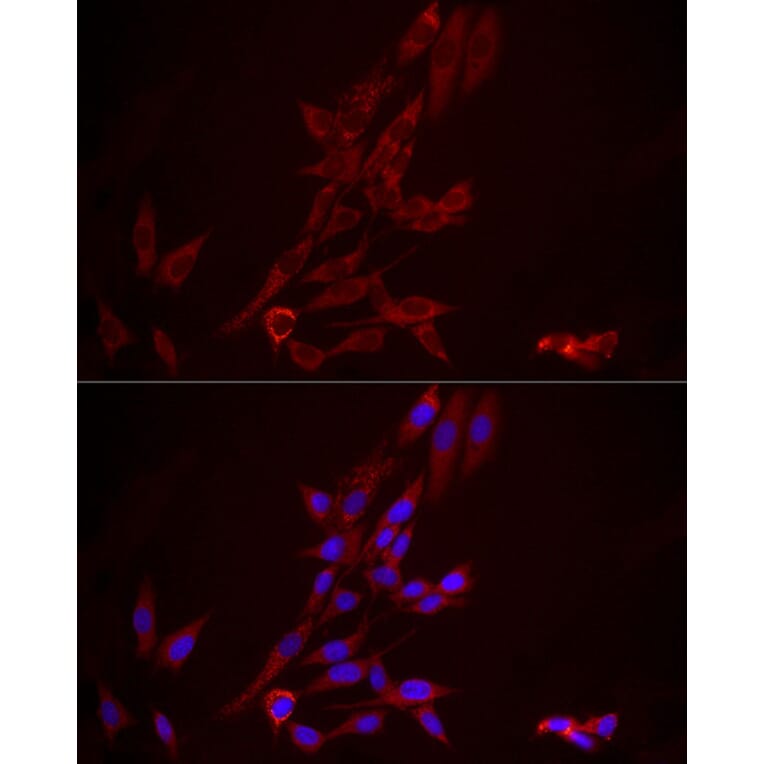 Immunofluorescence - Anti-FGF1 Antibody (A92157) - Antibodies.com