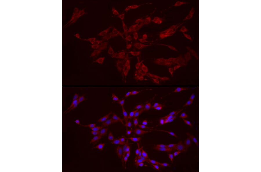 Immunofluorescence - Anti-FGF1 Antibody (A92157) - Antibodies.com