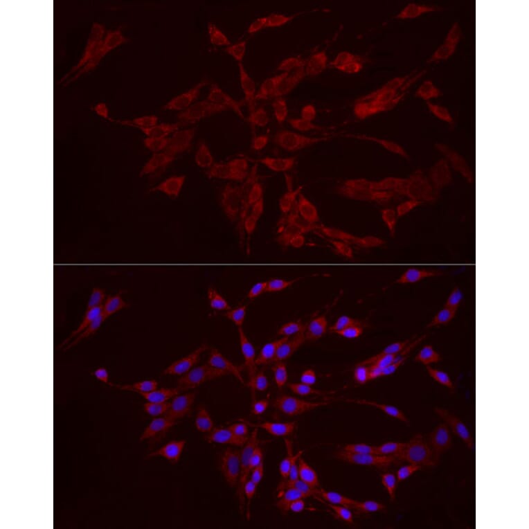 Immunofluorescence - Anti-FGF1 Antibody (A92157) - Antibodies.com