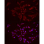 Immunofluorescence - Anti-FGF1 Antibody (A92157) - Antibodies.com