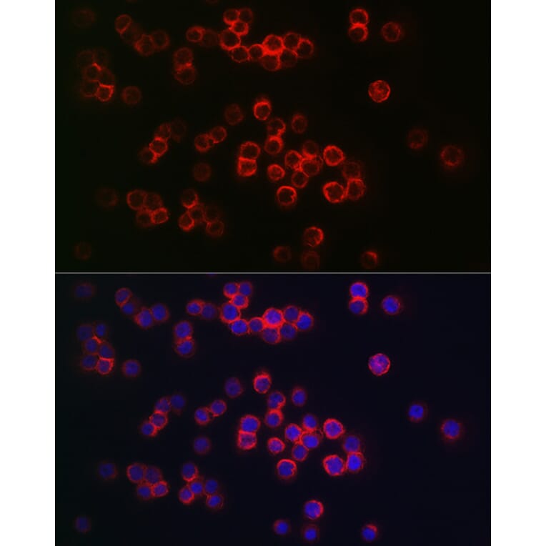 Immunofluorescence - Anti-CD68 Antibody (A92158) - Antibodies.com