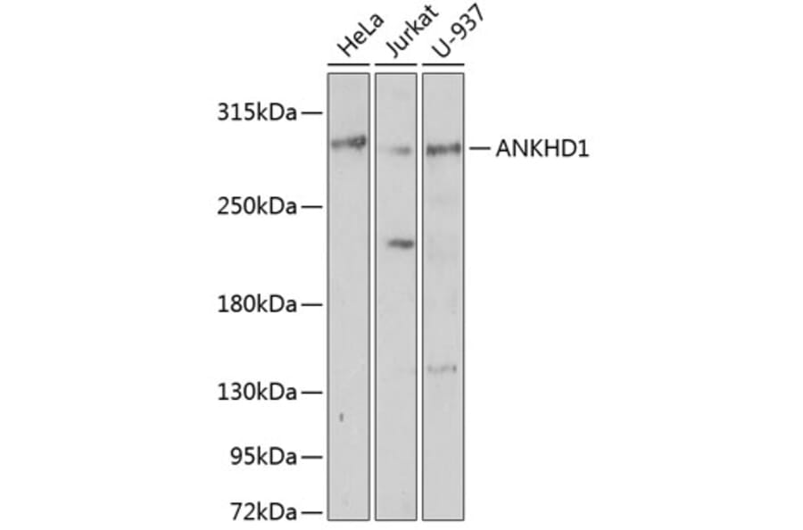 Western Blot - Anti-ANKHD1 Antibody (A92159) - Antibodies.com