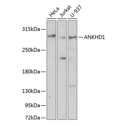 Western Blot - Anti-ANKHD1 Antibody (A92159) - Antibodies.com