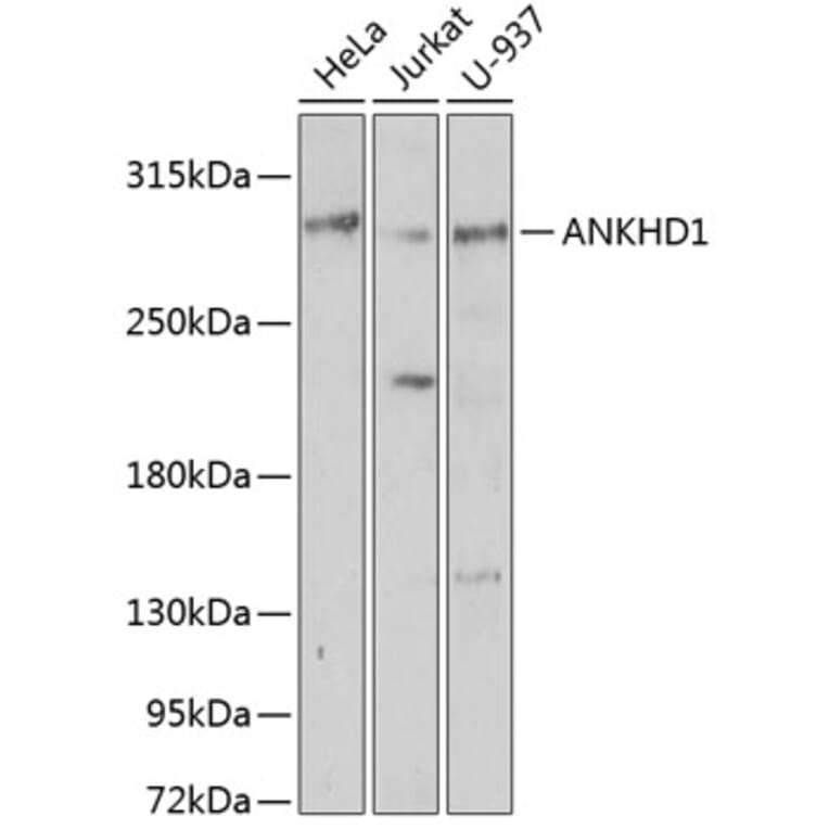 Western Blot - Anti-ANKHD1 Antibody (A92159) - Antibodies.com