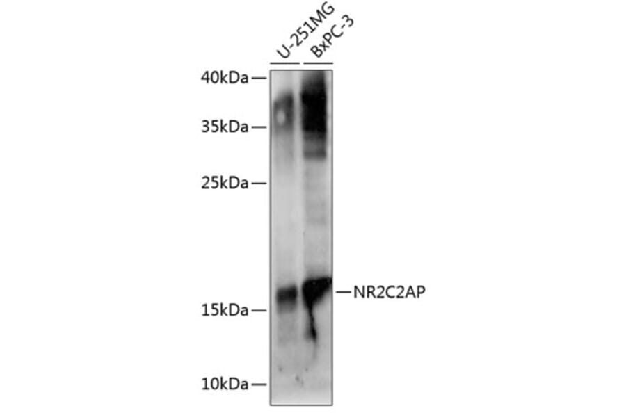Western Blot - Anti-ANKHD1 Antibody (A92159) - Antibodies.com
