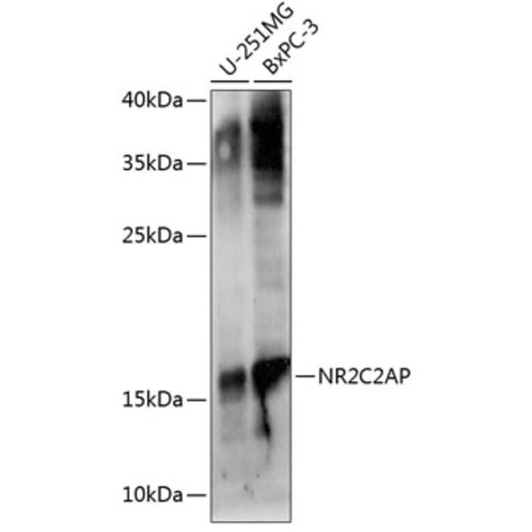 Western Blot - Anti-ANKHD1 Antibody (A92159) - Antibodies.com