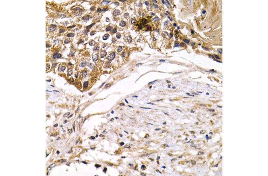 Immunohistochemistry - Anti-ARRB2 Antibody (A13278) - Antibodies.com