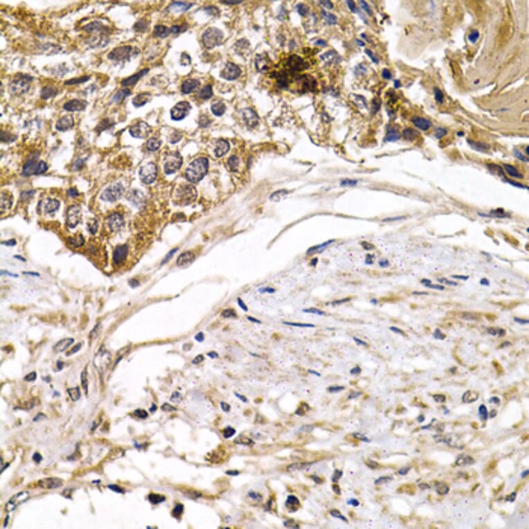 Immunohistochemistry - Anti-ARRB2 Antibody (A13278) - Antibodies.com