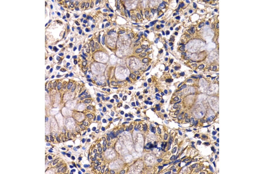 Immunohistochemistry - Anti-ARRB2 Antibody (A13278) - Antibodies.com