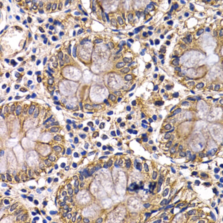 Immunohistochemistry - Anti-ARRB2 Antibody (A13278) - Antibodies.com