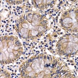 Immunohistochemistry - Anti-ARRB2 Antibody (A13278) - Antibodies.com