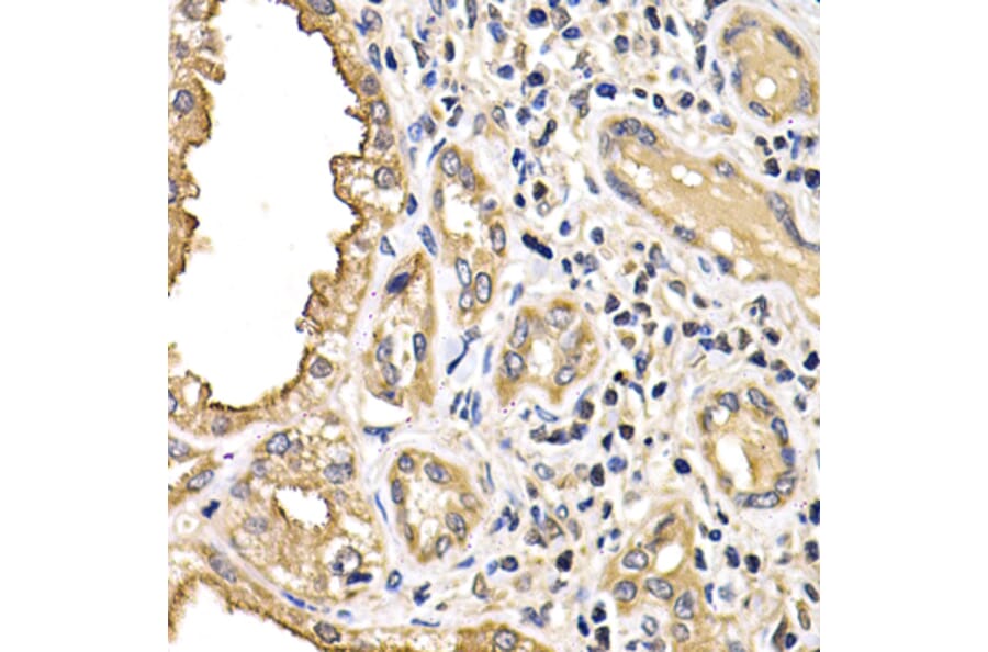 Immunohistochemistry - Anti-ARRB2 Antibody (A13278) - Antibodies.com
