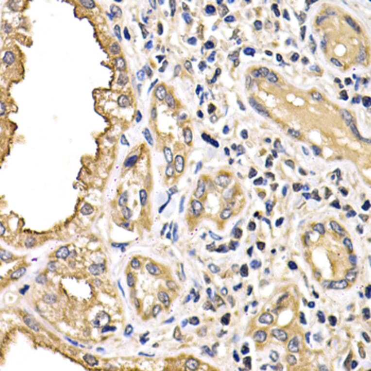 Immunohistochemistry - Anti-ARRB2 Antibody (A13278) - Antibodies.com