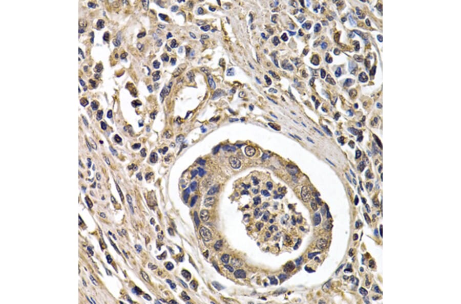 Immunohistochemistry - Anti-ARRB2 Antibody (A13278) - Antibodies.com