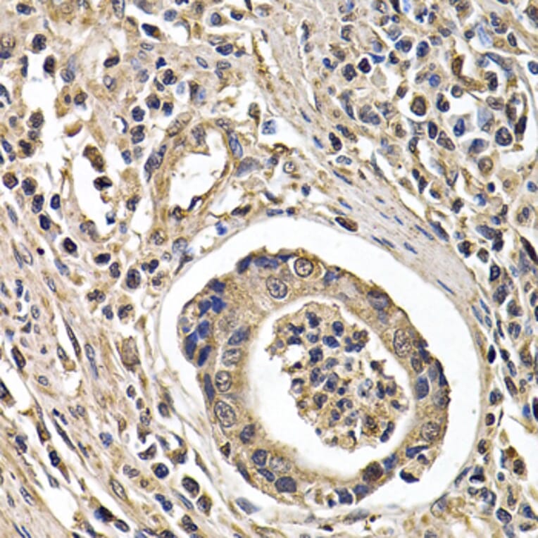Immunohistochemistry - Anti-ARRB2 Antibody (A13278) - Antibodies.com