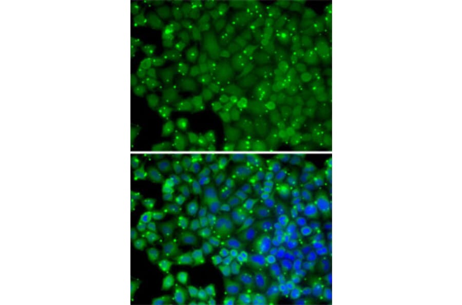 Immunofluorescence - Anti-ARRB2 Antibody (A13278) - Antibodies.com