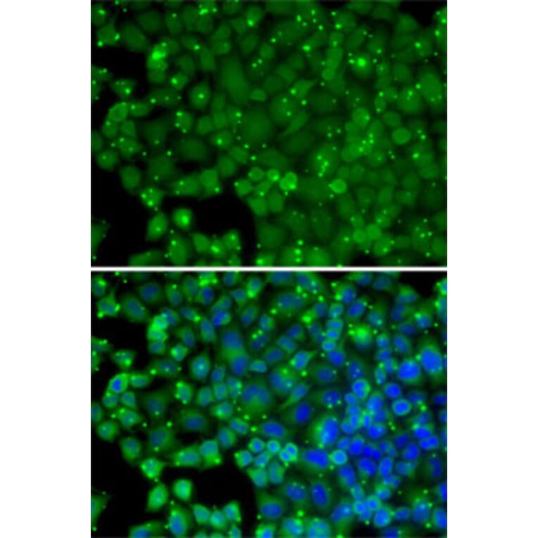 Immunofluorescence - Anti-ARRB2 Antibody (A13278) - Antibodies.com