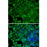 Immunofluorescence - Anti-ARRB2 Antibody (A13278) - Antibodies.com