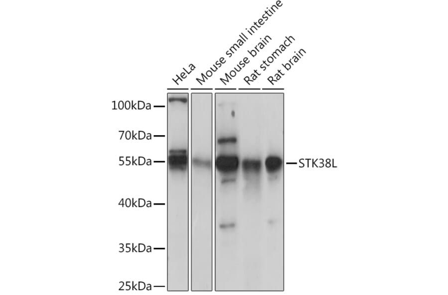 Western Blot - Anti-STK38L/Ndr2 Antibody (A92163) - Antibodies.com