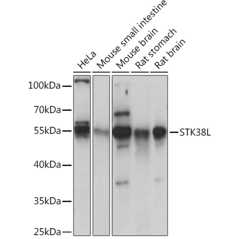 Western Blot - Anti-STK38L/Ndr2 Antibody (A92163) - Antibodies.com