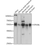 Western Blot - Anti-STK38L/Ndr2 Antibody (A92163) - Antibodies.com