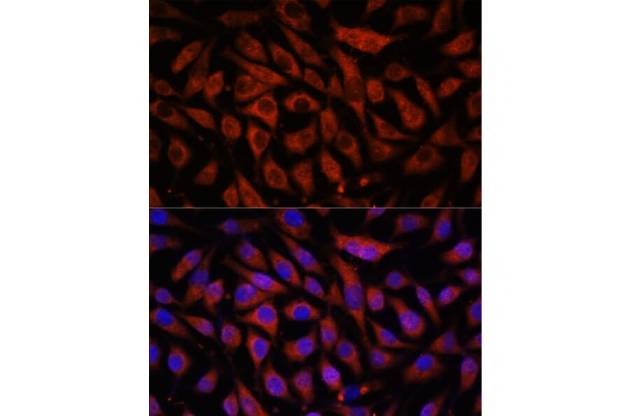 Immunofluorescence - Anti-STK38L/Ndr2 Antibody (A92163) - Antibodies.com