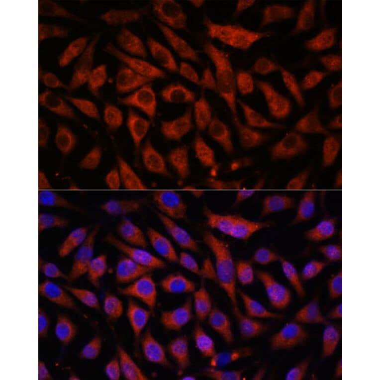 Immunofluorescence - Anti-STK38L/Ndr2 Antibody (A92163) - Antibodies.com
