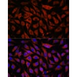 Immunofluorescence - Anti-STK38L/Ndr2 Antibody (A92163) - Antibodies.com