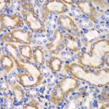 Immunohistochemistry - Anti-UGDH Antibody (A92164) - Antibodies.com