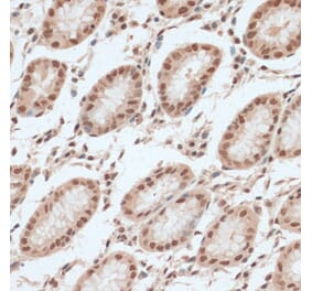 Immunohistochemistry - Anti-ZNF574 Antibody (A92166) - Antibodies.com