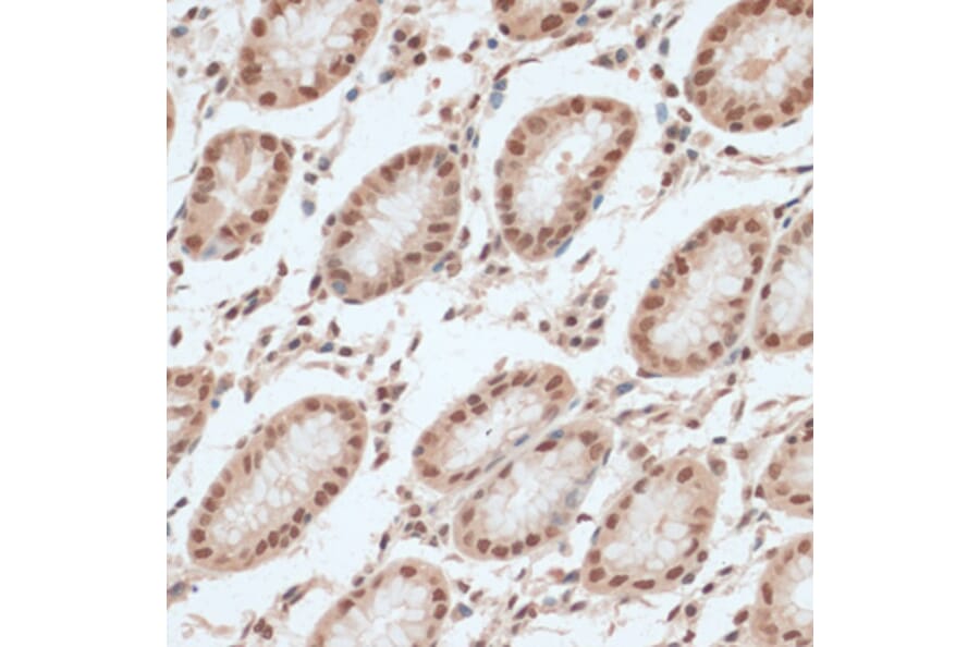 Immunohistochemistry - Anti-ZNF574 Antibody (A92166) - Antibodies.com