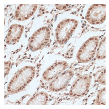 Immunohistochemistry - Anti-ZNF574 Antibody (A92166) - Antibodies.com
