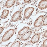 Immunohistochemistry - Anti-ZNF574 Antibody (A92166) - Antibodies.com