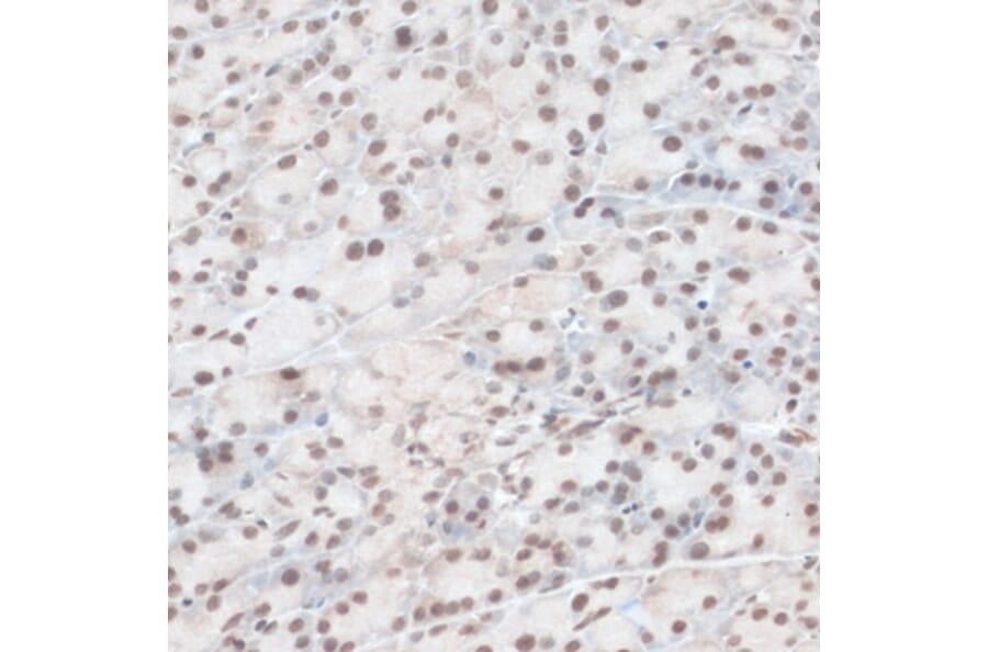 Immunohistochemistry - Anti-ZNF574 Antibody (A92166) - Antibodies.com