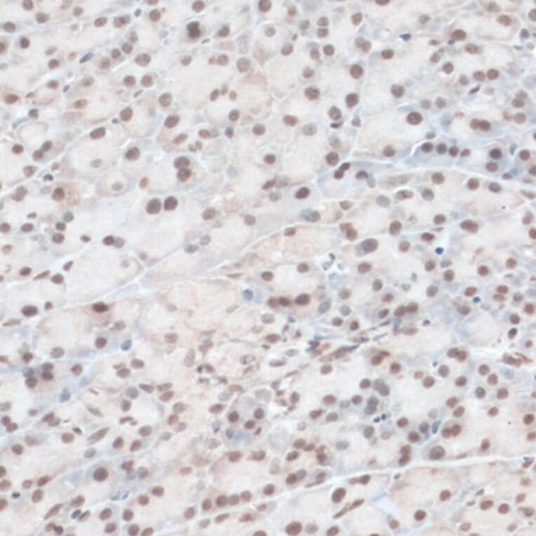 Immunohistochemistry - Anti-ZNF574 Antibody (A92166) - Antibodies.com