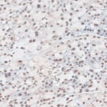 Immunohistochemistry - Anti-ZNF574 Antibody (A92166) - Antibodies.com