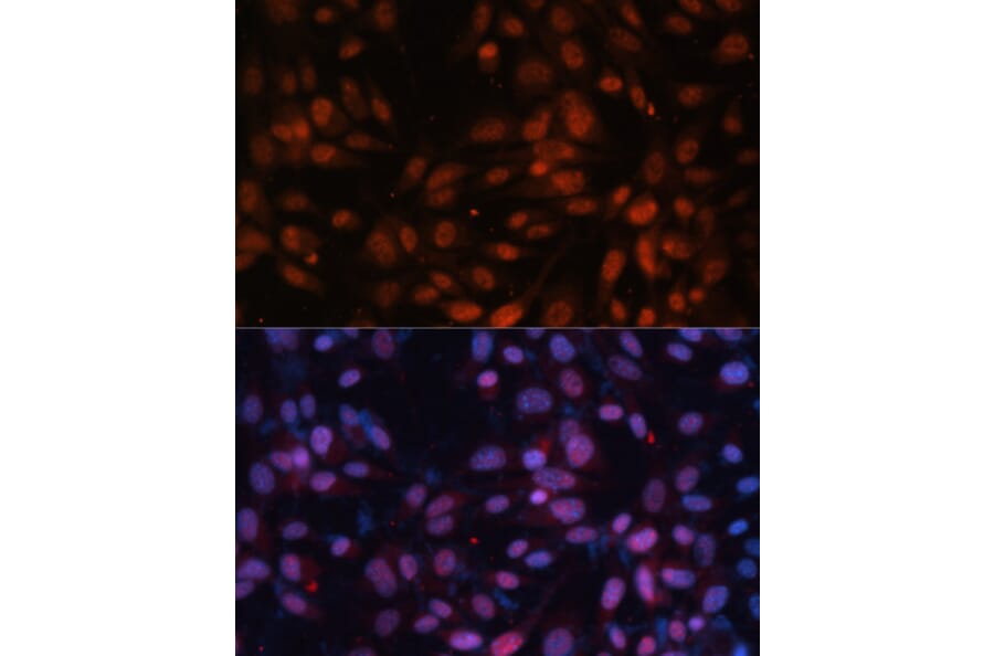 Immunofluorescence - Anti-ZNF574 Antibody (A92166) - Antibodies.com