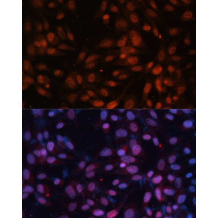 Immunofluorescence - Anti-ZNF574 Antibody (A92166) - Antibodies.com