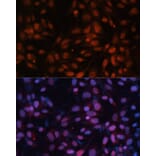 Immunofluorescence - Anti-ZNF574 Antibody (A92166) - Antibodies.com