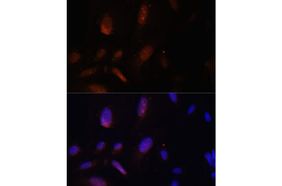 Immunofluorescence - Anti-ZNF574 Antibody (A92166) - Antibodies.com
