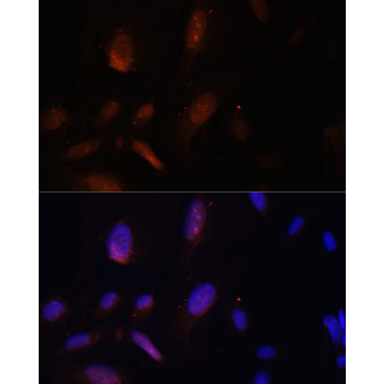 Immunofluorescence - Anti-ZNF574 Antibody (A92166) - Antibodies.com