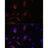 Immunofluorescence - Anti-ZNF574 Antibody (A92166) - Antibodies.com