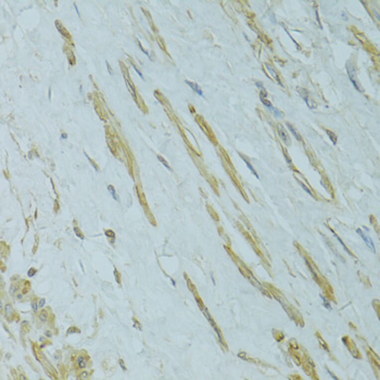 Immunohistochemistry - Anti-IFT57 Antibody (A14652) - Antibodies.com