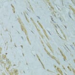 Immunohistochemistry - Anti-IFT57 Antibody (A14652) - Antibodies.com