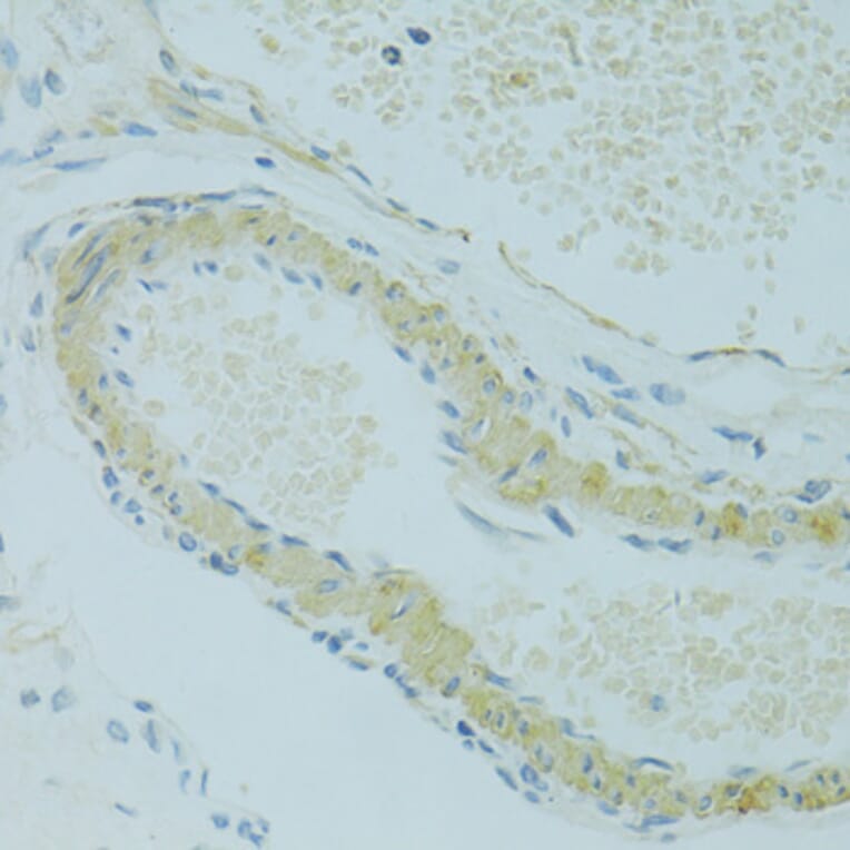 Immunohistochemistry - Anti-IFT57 Antibody (A14652) - Antibodies.com