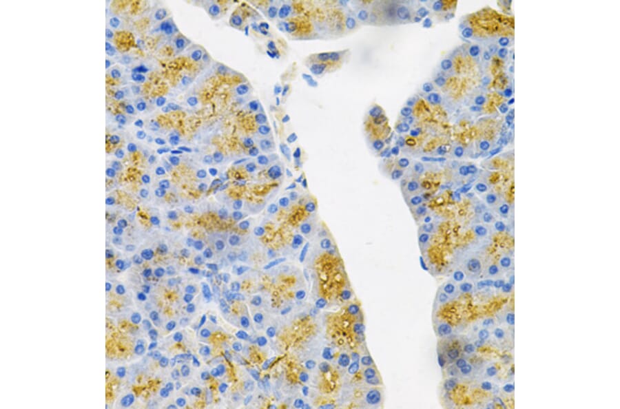 Immunohistochemistry - Anti-EDN3 Antibody (A13974) - Antibodies.com