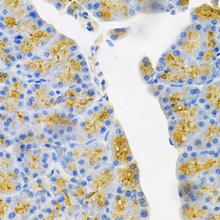 Immunohistochemistry - Anti-EDN3 Antibody (A13974) - Antibodies.com